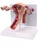 Die besten Produkte zur Behandlung von Ovarialzysten: Analyse und Vergleich für Damen