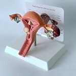 Uterus Bicornis: Analyse und Vergleich der besten Damenprodukte für eine gesunde Gebärmutter